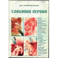 Слабинна херния